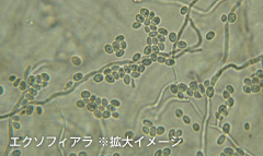 エクソフィアラ